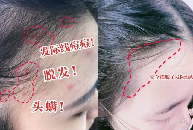 ?10分钟轻松养成女明星「绸缎发」开元棋牌洗完头自然风干还是吹干好(图14) ?10分钟轻松养成女明星「绸缎发」开元棋牌洗完头自然风干还是吹干好(图14)